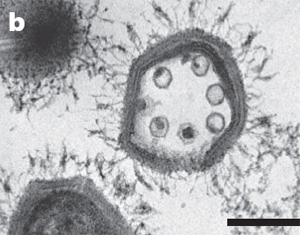 Гигант мимивирус эчендә кечкенә иярчен вирус кисәкчәләре. Масштаблы сызгычның озынлыгы 200 нм. Фото Nature мәкаләсеннән алынды.