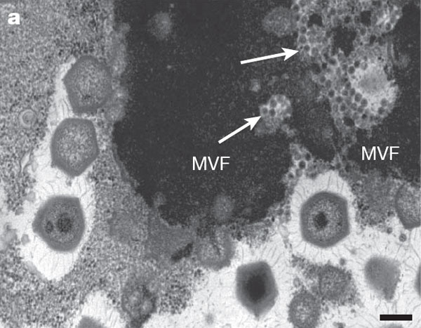 Кара төстәге өлкә – амеба цитоплазмасында мимивирусның «вируслар фабрикасы». Зур алтыпочмаклыклар – өлгерүнең төрле стадиясендәге мимивирус кисәкчәләре. Уклар белән иярчен вирус тупланган урыннар күрсәтелгән. Масштаблы сызгычның озынлыгы 200 нм. Фото Nature мәкаләсеннән алынды.